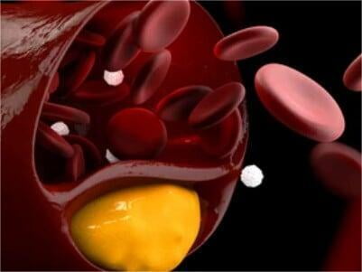 Biotin Cholesterol for Targeted Drug Delivery